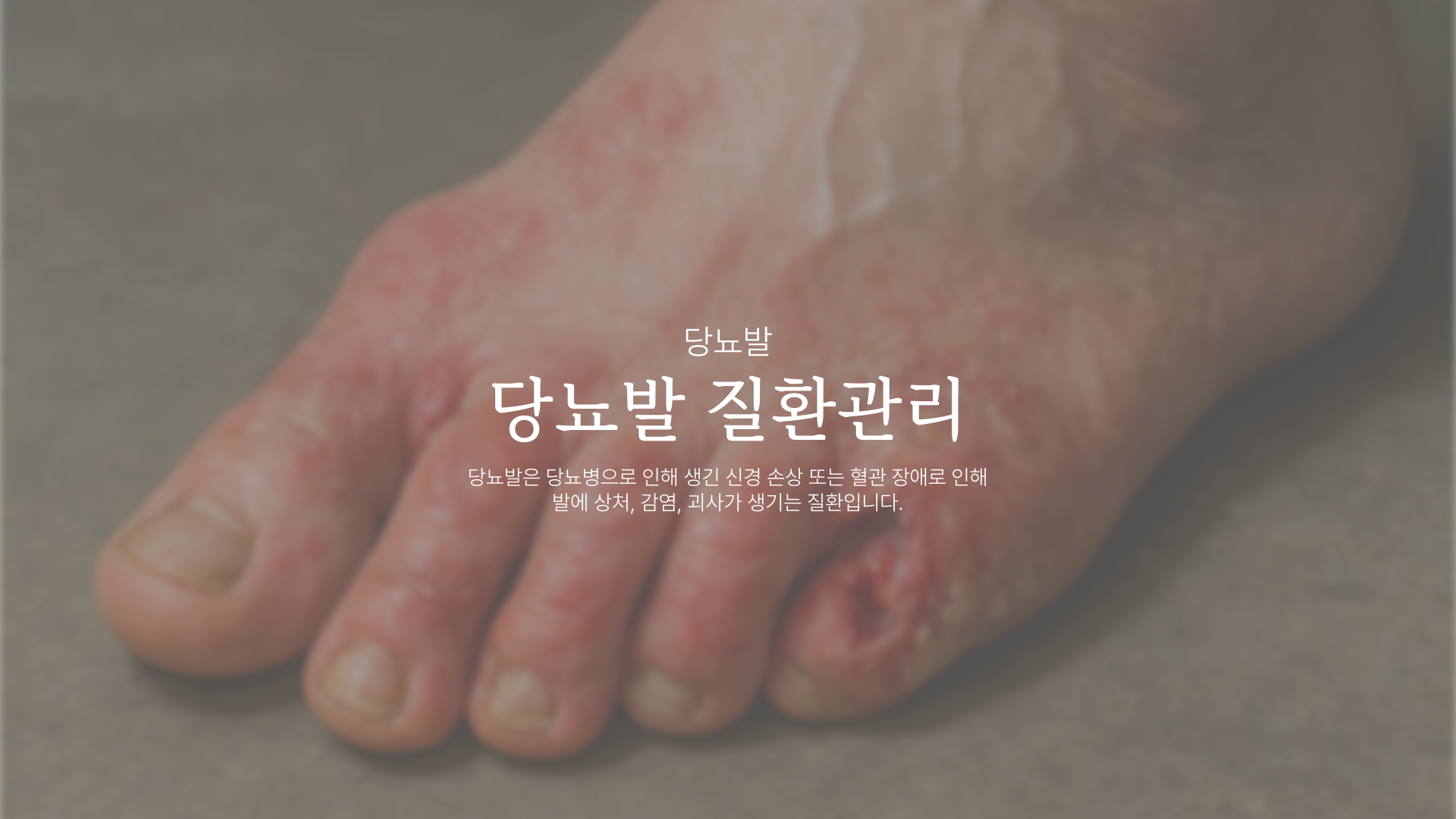 �索�� ��ȯ����