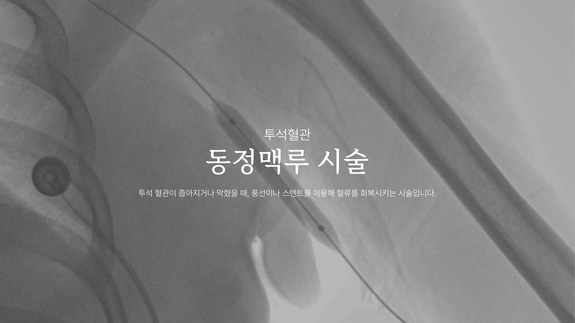 �����Ʒ� �ü�