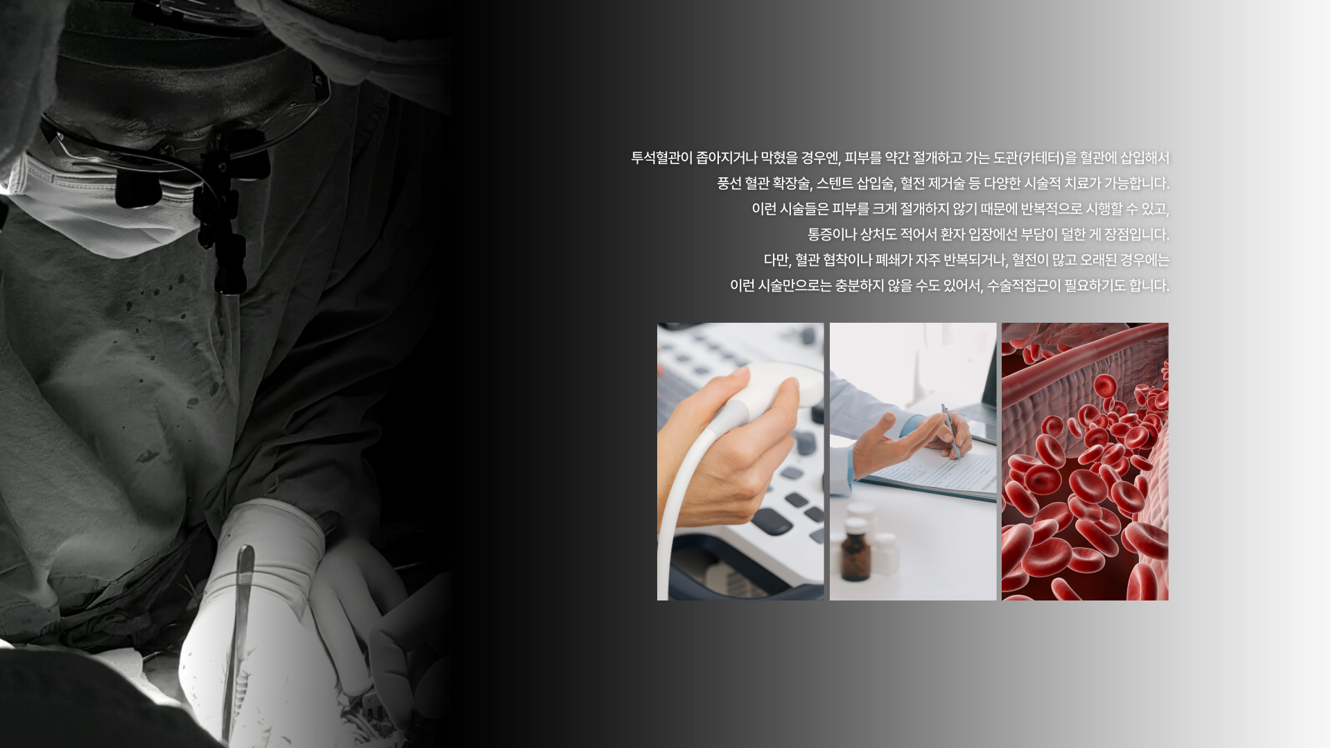 �����Ʒ� �ü�