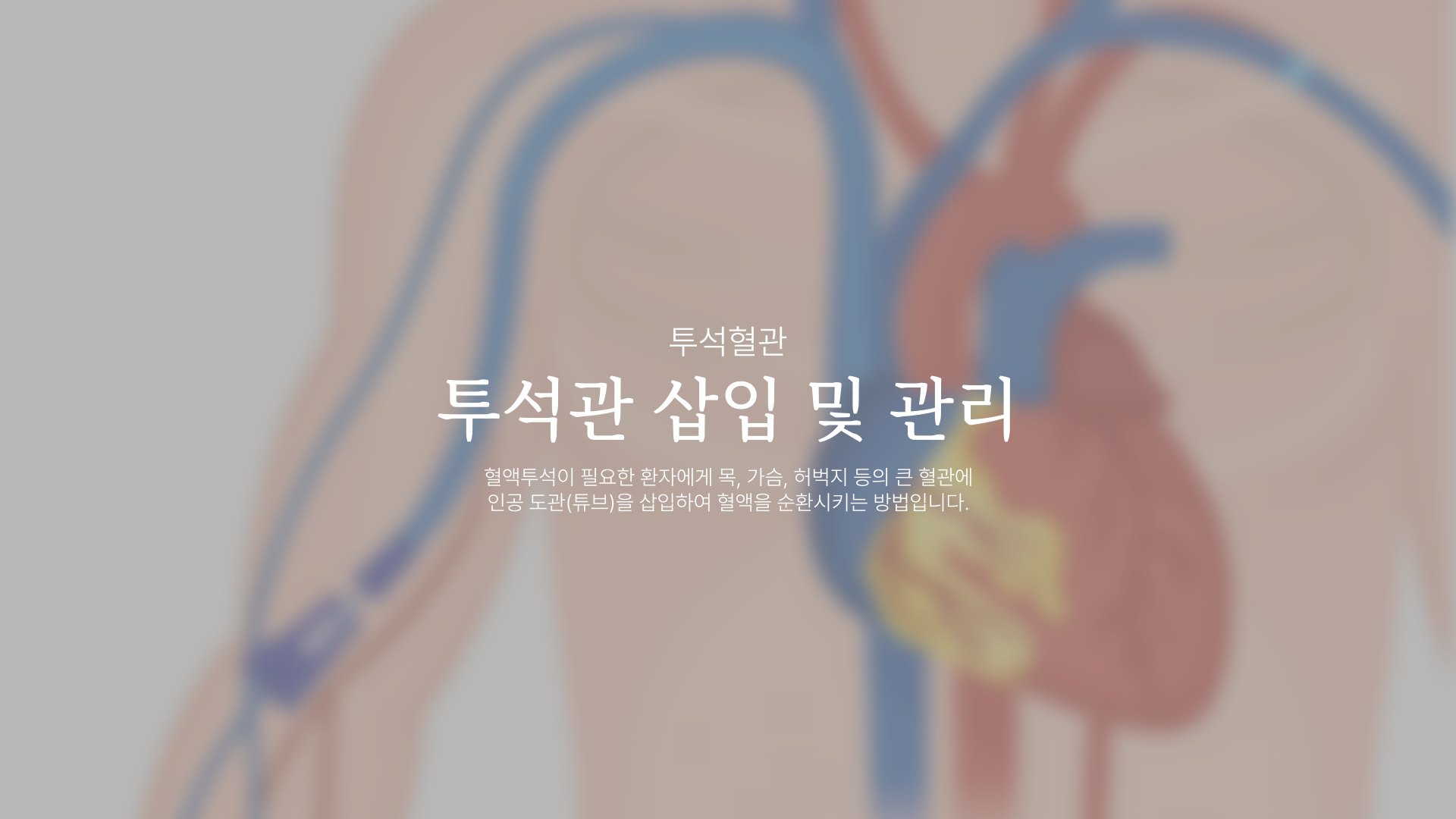 ������ ���� �� ����