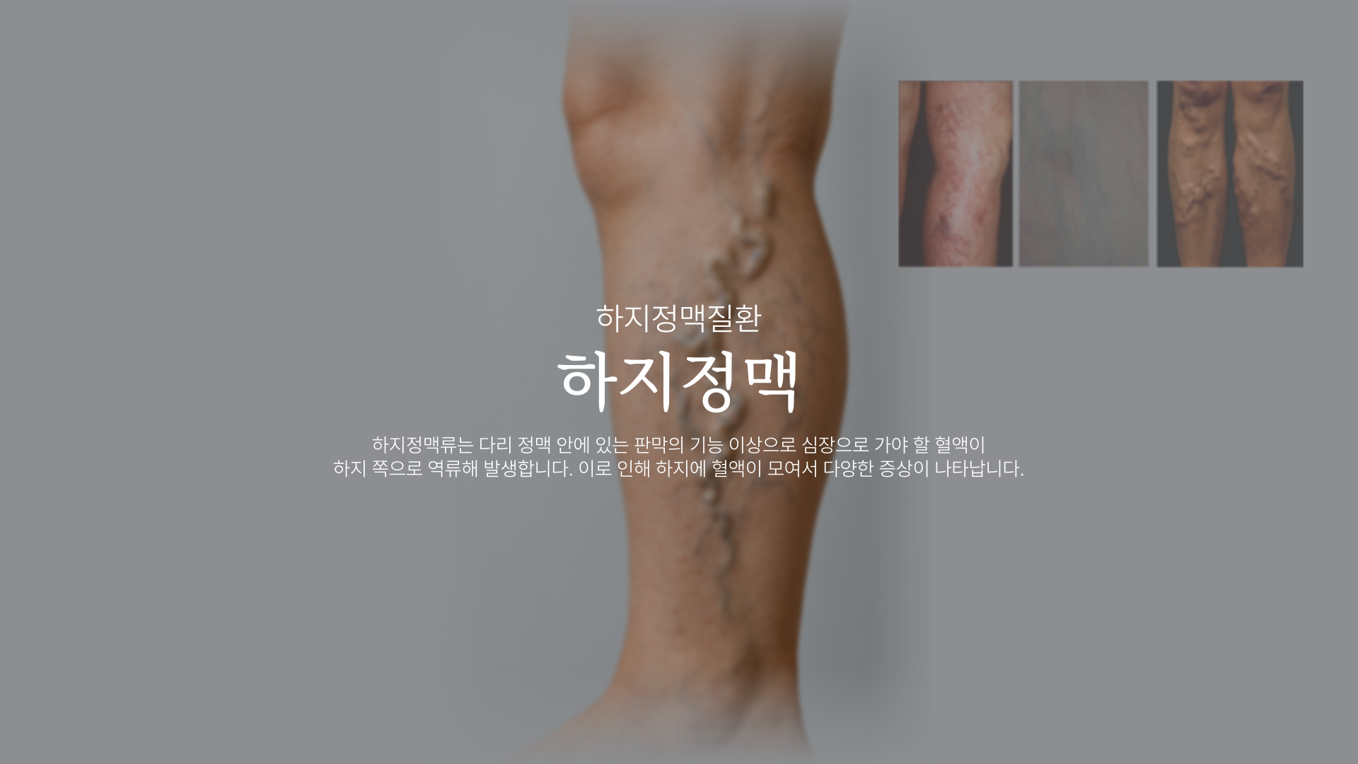 ���� ���Ʒ�