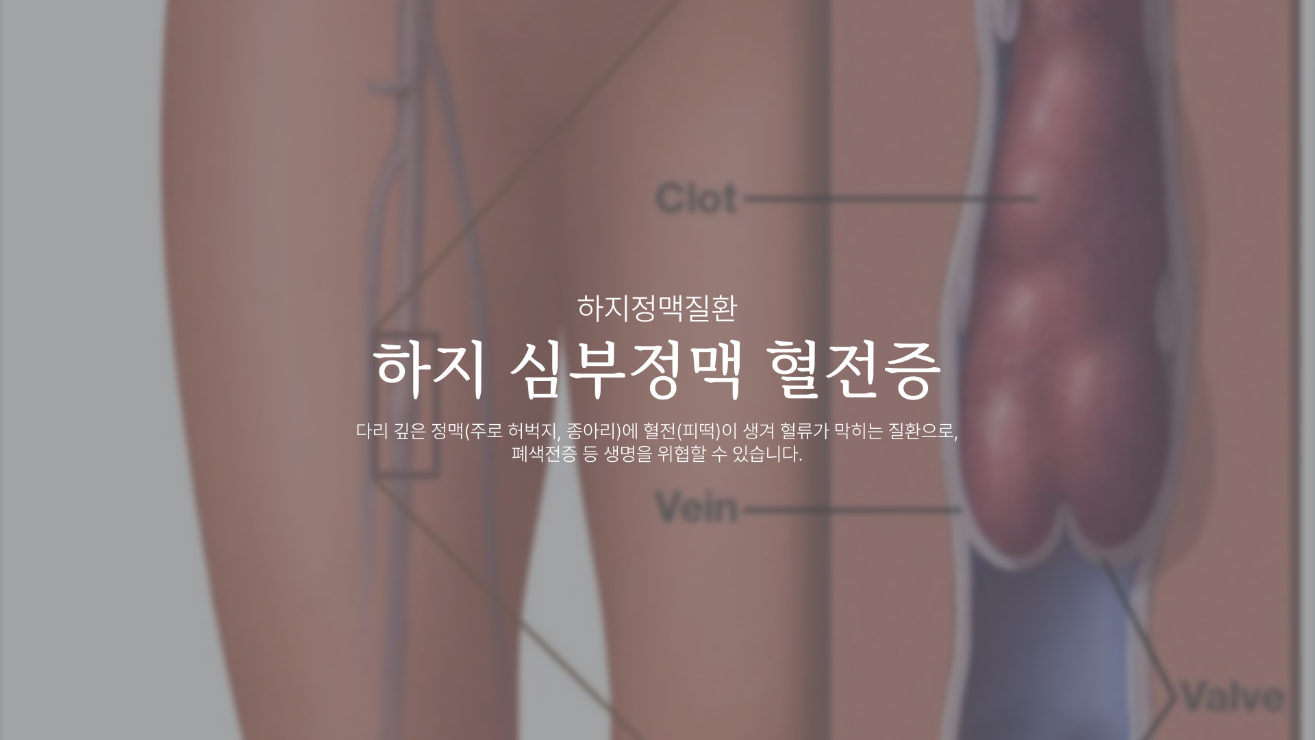 �ɺ����� ������